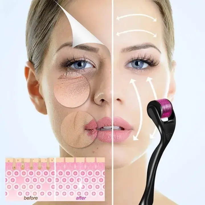 Derma Roller before and after face and hair results - DrutoBD